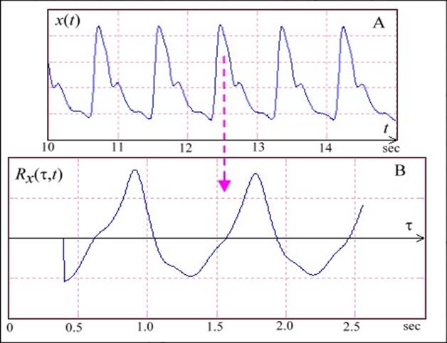 Fig1